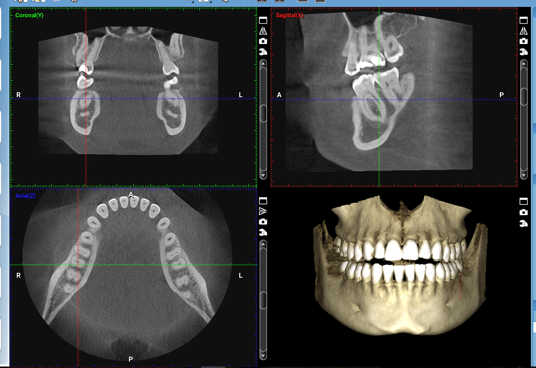 CBCT.png